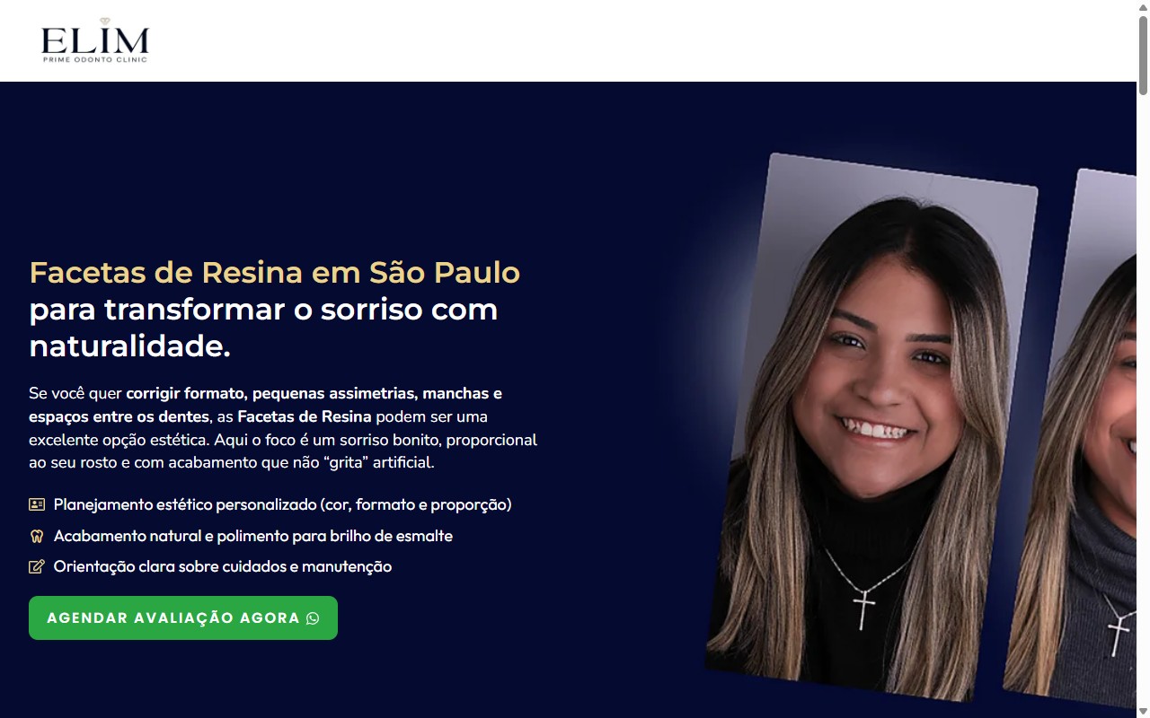 Elim Prime — Facetas Dentárias